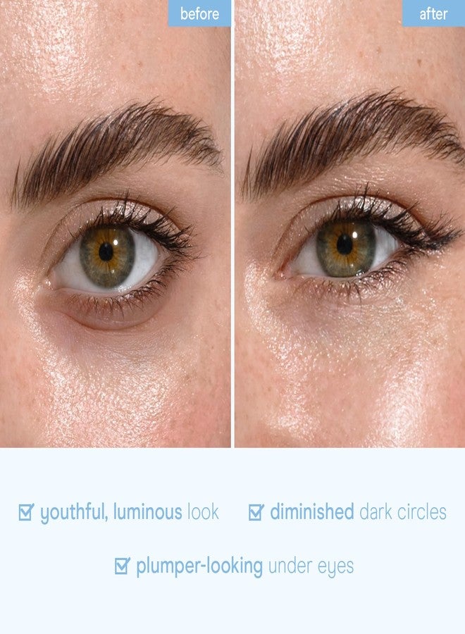 بيبادي لصقات بايبودي المتقدمة للعينين بخلاصة الحلزون للنساء والرجال (6 أزواج) - أقنعة للعينين لعلاج الهالات السوداء والانتفاخ - مع النياسيناميد - تقلل من الخطوط الدقيقة والتجاعيد - Image 5